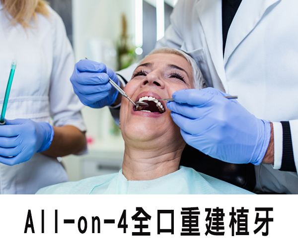 All-on-4植牙-經濟實惠又安全的植牙手術